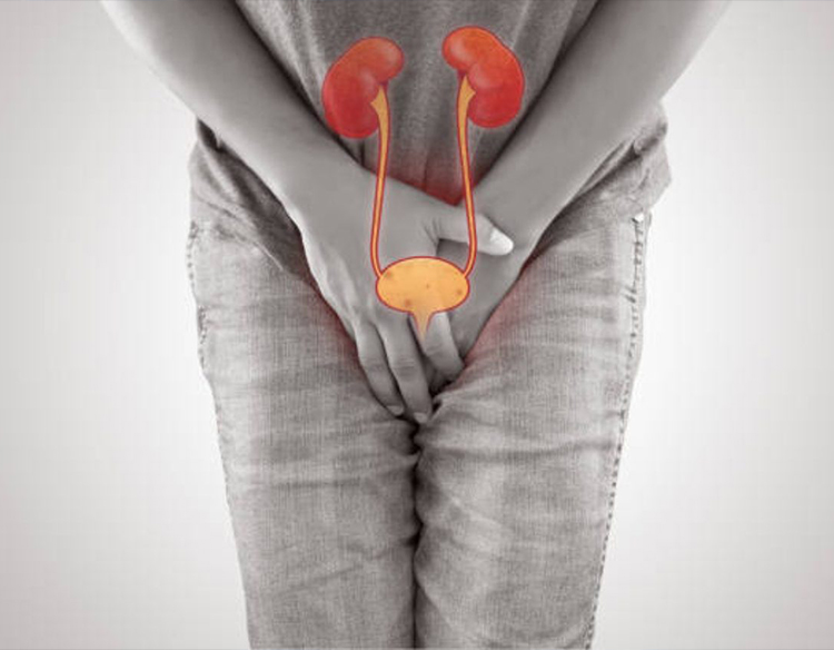 Infecciones urinarias: causas, síntomas, tratamiento y prevención