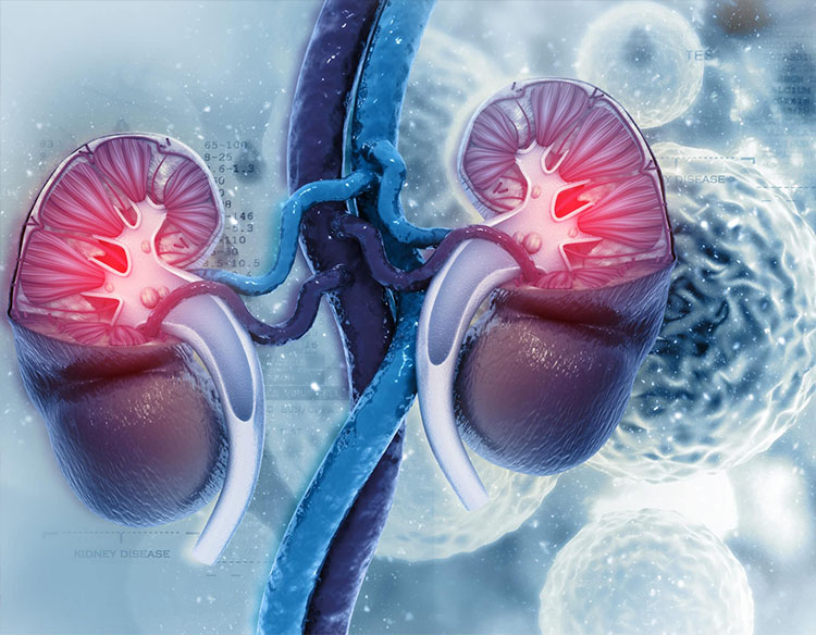 Cáncer de riñón: entendiendo la enfermedad y sus posibles tratamientos
